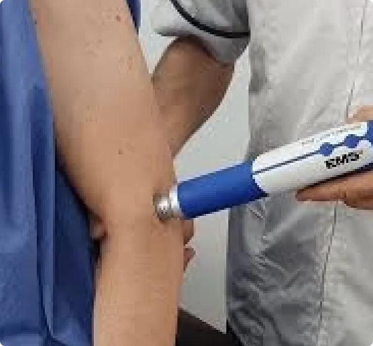 Shockwave Therapy (ESWT) - 3
